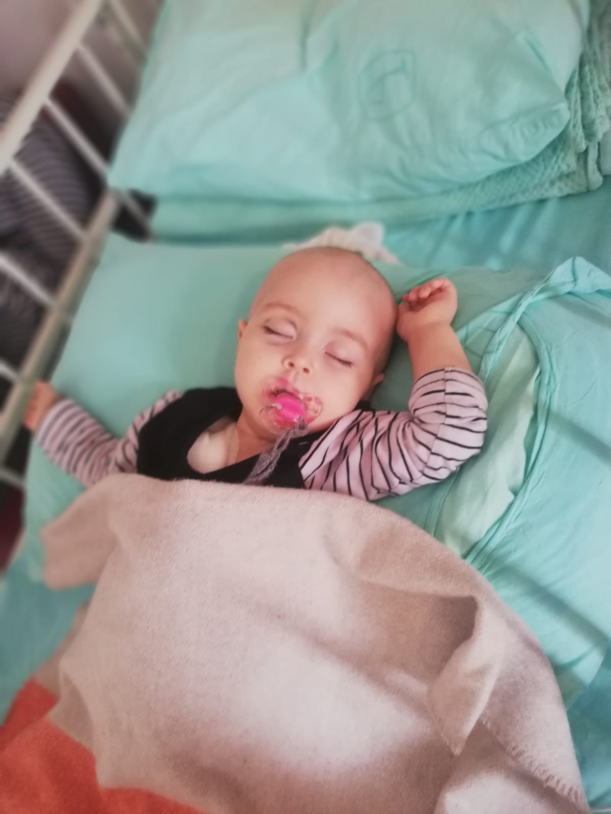 Zonguldak’ta 14 aylık Zekiye bebek kanserle savaşıyor
